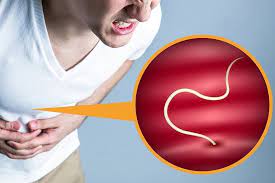 魚に寄生アニサキス、日本海側は食中毒「なりにくい」はずが「なりやすいタイプ」急増中