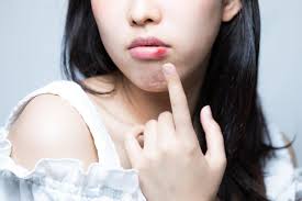 【悲報】赤ちゃんの先天梅毒症、過去最多