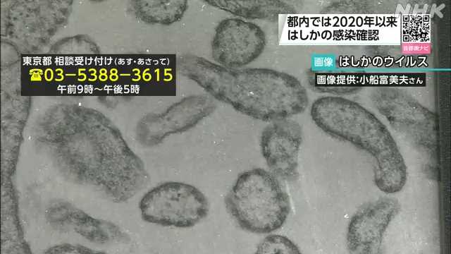 【朝日新聞】はしか患者が増加　「万博もリスク」　すでに昨年の報告数を上回る