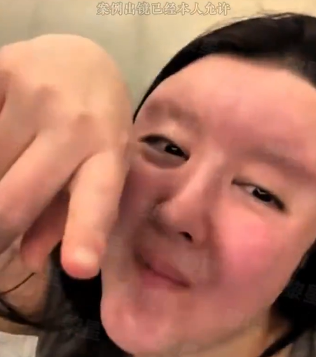 【動画】　中国で美容整形を受けた結果　w