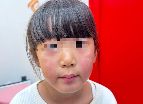 【日本でリンゴ病流行】中国ネット 「中国に持ち込まないで」