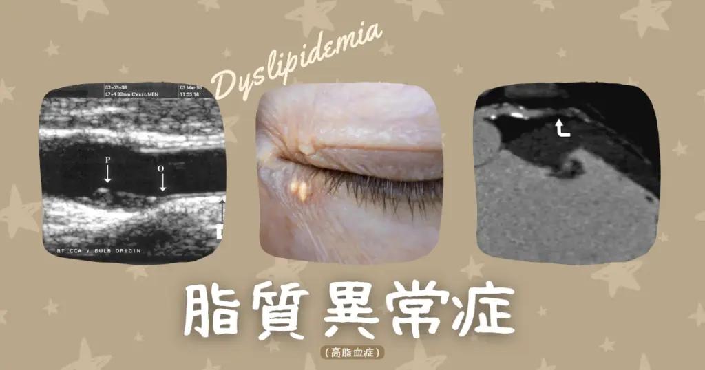 肝機能障害・脂質異常の太め、たまごを食うと死ぬと発表、健常者は1日2～3個の卵を食べても大丈夫