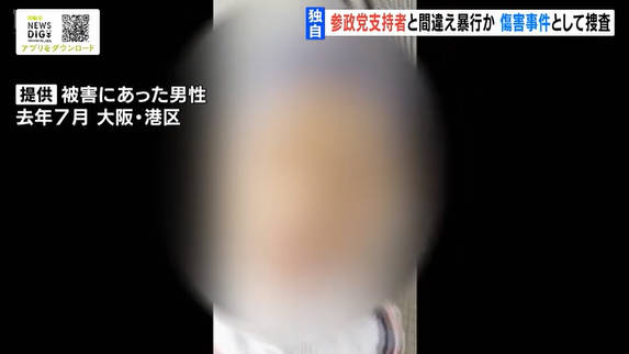 一般人を骨折させた自称しばき隊さん、なぜかよく似た人が共産党の選挙カーで街宣